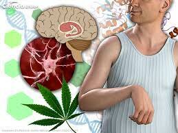 GEORGE HUNTINGTON (1872). Médico estadounidense