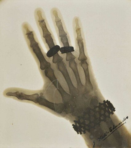 Efectos biológicos de la radiación