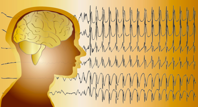 Encefalografia - Hans Berger 1924