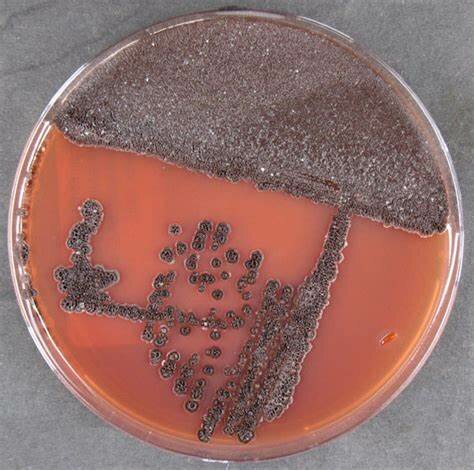 Saccharopolyspora erythraea