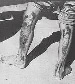 Efectos Biológicos de la Radiación