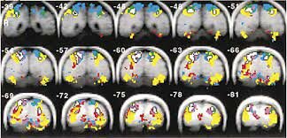 SEIJI OGAWA (1990). Neurocientifico japonés