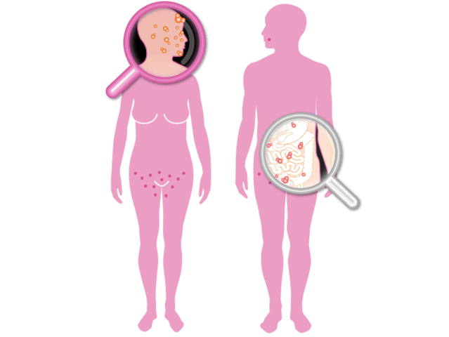 Edad media (Siglo XV)