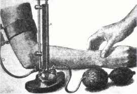 El primer tensiómetro