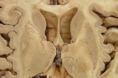 CHARLES BELL 1774 - 1842