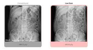 Magnitudes y unidades radiologicas