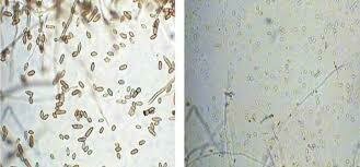LA TEORÍA MICROBIANA SIN PASTEUR Y KOCH