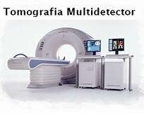 1998 tomografia multidetector