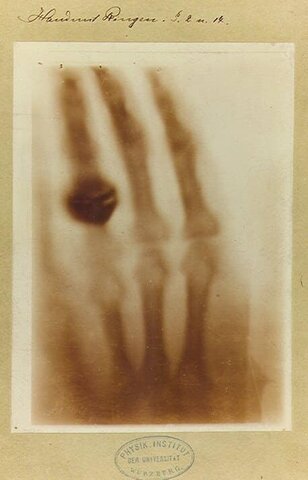 aplicaciones desde 1895 de radiacion ionizante en diagnostico hasta el dia de hoy