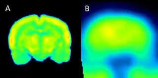 aplicaciones desde 1895 de radiacion ionizante en diagnostico hasta el dia de hoy