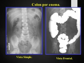 1910 Magnitudes, unidades y limitación de dosis de radiación utilizadas