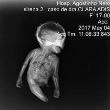 •	Magnitudes, unidades y limitación de dosis de radiación utilizadas