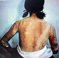 •	Comité internacional de protección radiológica