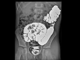 •	Aplicaciones desde 1895 hasta nuestros días de la radiación ionizante en diagnóstico