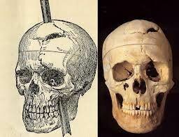 Abre estudio corteza prefrontal Phineas Gage (1848)