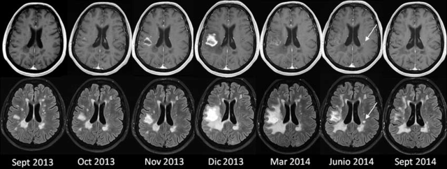 Resonancia magnetica (MRI) 1970