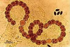 LA TEORÍA MICROBIANA