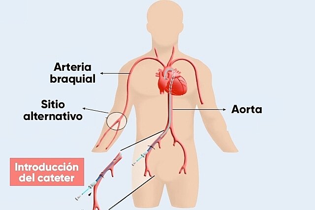 1929 Aplicaciones desde 1895 hasta nuestros dias
