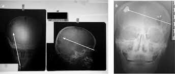 2013 Aplicaciones pasadas y presentes
