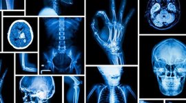 Timeline: Linea de tiempo Radiología y Radioproteccion