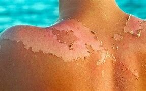 Efectos bilógicos de la radiación