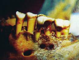 Odontología en Egipto