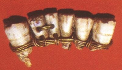 Se realizaban prótesis dentales