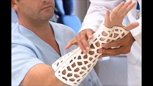 Gran avance en la prótesis