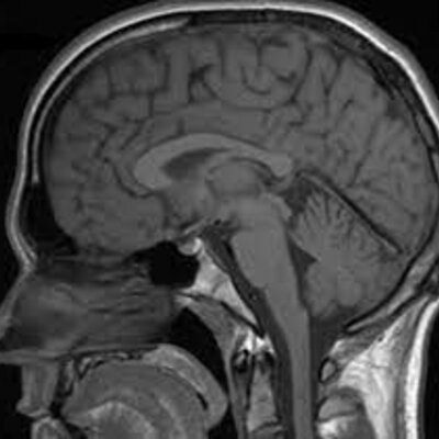 Timeline: Historia de la resonancia magnética