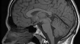 Timeline: Historia de la resonancia magnética