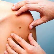 Prevenir efectos agudos