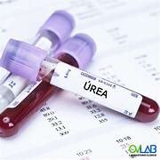 Síntesis de la úrea