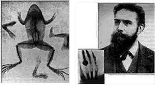 Nace la imagenología, la radiología y el desarrollo de la tomografia