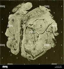 Imágenes del estomago y tracto gastrointestinal