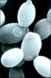 FERMENTAZIONE (GLICOLISI)