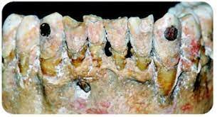 REVISTA LA ODONTOLOGÍA MEXICANA