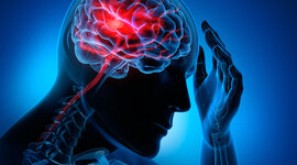 Timeline: Accidente Cerebrovascular