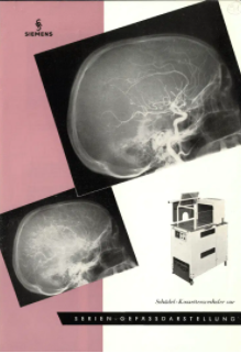Angiografias seriales