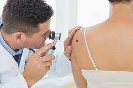 Skin Cancer Screening (Monthly & Yearly)