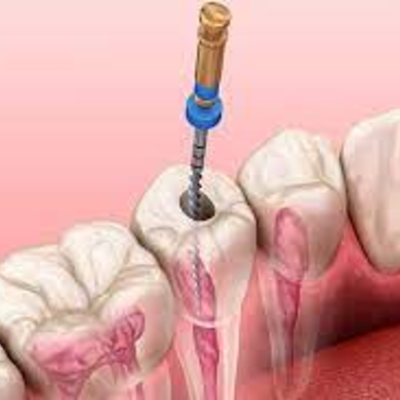 Timeline: "Breve historia de la Endodoncia"