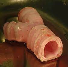 Primer trasplante de de órgano cultivado