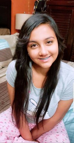 Me pusieron Brackets