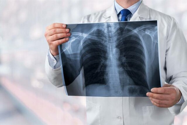 Efectos biológicos de la radiación