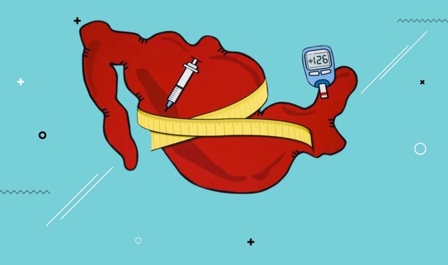 Sobrepeso y obesidad en México