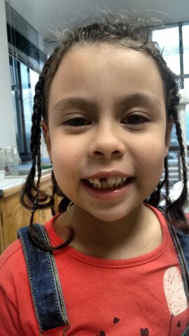 Mudando mi primer diente