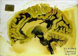 PENSAMIENTOS FRANCESES ANATOMO CLINICAS