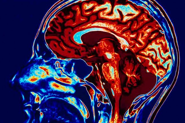 *Década de 1910* -Dopamina [ C8H11NO2 ]