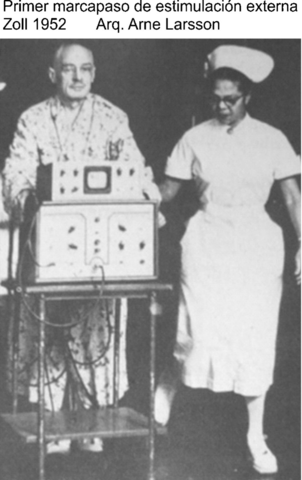 Marcapasos externo, 1956