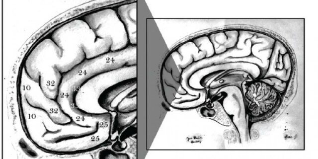 Década del cerebro.
