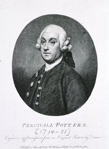 Sir PERCIVAL POTT
